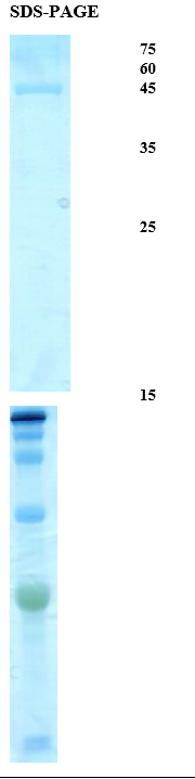 Treponema pallidum (Syphilis) p15 Recombinant Protein