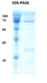 Treponema pallidum (Syphilis) p15/p17/p47 Fusion  Recombinant Protein