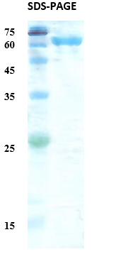 Treponema pallidum (Syphilis) p17/p47 Fusion  Recombinant Protein