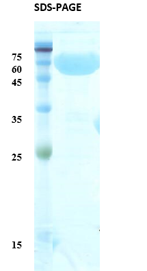 Treponema pallidum (Syphilis) p47 Recombinant Protein