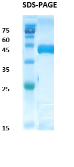 Trypanosoma cruzi chimeric chagas Recombinant Protein