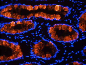 Tumor associated glycoprotein (TAG) 72 Antibody [B72.3 (Satumomab)], Mouse IgG1 - Research Grade Biosimilar