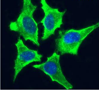 VAP-1 Antibody [2D10], Rabbit IgG