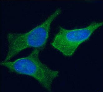 VAP-1 Antibody [TK8-14], Rabbit IgG