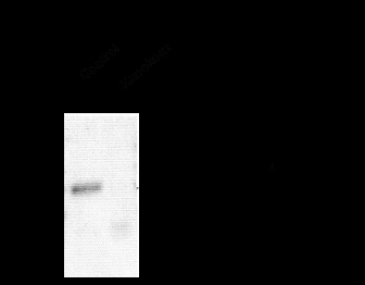 GABA A Receptor alpha 1 Antibody