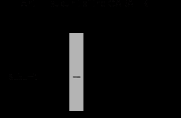 GABA A Receptor gamma 2 Antibody