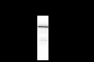 NMDA NR2A Antibody