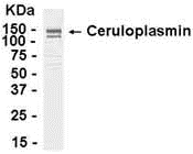 CP Antibody