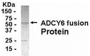 ADCY6 Antibody