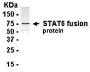 STAT6 Antibody