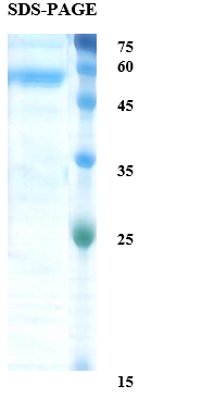 Zika virus NS1 protein  Recombinant Protein