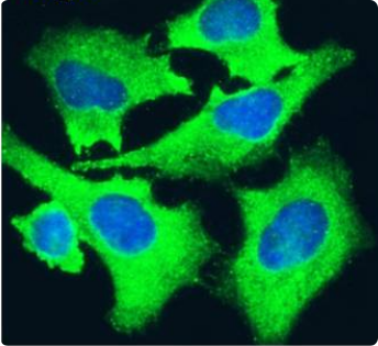 alpha 5 beta 1 Integrin Antibody [M200 (Volociximab)], Rabbit IgG - Research Grade Biosimilar