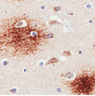 amyloid beta Antibody [6E10], Rabbit IgG