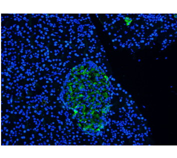 carcinoembryonic antigen (CEA) Antibody [Arcitumomab], Human IgG1 - Research Grade Biosimilar