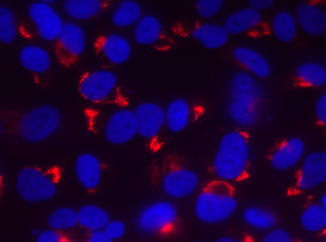 dsRNA Antibody [1D3], Rabbit IgG