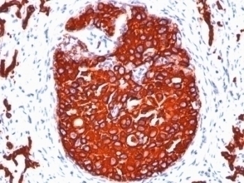 pan Cytokeratin Antibody [KRTL/1077 + KRTH/1076]