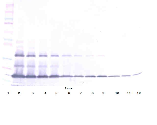 sFas Receptor Antibody