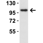 <strong> Figure 1 WB Validation in K562 Cells </strong><br>Loading: 10 μg of lysate Antibodies: IL-17RA, 7419, 4 μ g/mL , 1 h incubation at RT in 5% NFDM/TBST. Secondary: Goat Anti-Rabbit IgG HRP conjugate at 1:10000 dilution.