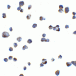 Immunocytochemistry of KIR2DS2 in Hek293 cells with KIR2DS2 antibody at 5 μg/mL.