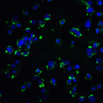 Immunofluorescence of KIR2DS2 in Hek293 cells with KIR2DS2 antibody at 20 μg/mL.<br><br>Green: KIR2DS2 Antibody (8201) <br> Blue: DAPI staining