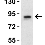 <strong>Figure 3 WB Validation in Rat Brain </strong><br>Loading: 15 μg of lysate Antibodies: Nhe-1, 4379, 1 μg/mL , 1 h incubation at RT in 5% NFDM/TBST. Secondary: Goat Anti-Rabbit IgG HRP conjugate at 1:10000 dilution.