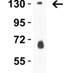 <strong>Figure 2 WB Validation in Mouse Lung </strong><br>Loading: 15 μg of lysate Antibodies: PRDM16, 5555, 2 μg/mL , 1 h incubation at RT in 5% NFDM/TBST. Secondary: Goat Anti-Rabbit IgG HRP conjugate at 1:10000 dilution.
