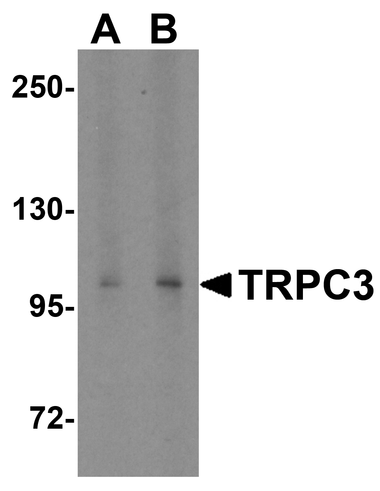 TRPC3 Antibody