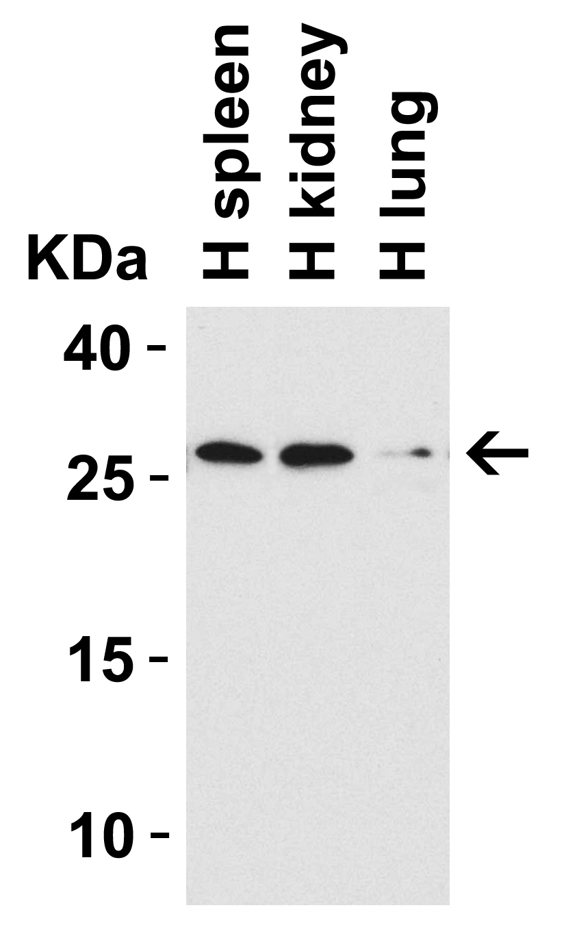 CIDE-B Antibody