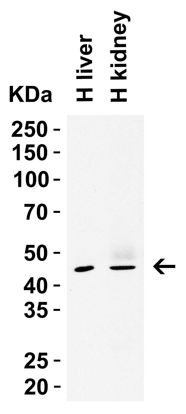 SIGLEC15 Antibody