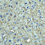<strong>Figure 6 Immunohistochemistry Validation of TSLP in Human Brain Tissue </strong><br> Immunohistochemical analysis of paraffin-embedded Human Brain Tissue using anti-TSLP antibody (4023) at 2.5 μg/ml. Tissue was fixed with formaldehyde and blocked with 10% serum for 1 h at RT; antigen retrieval was by heat mediation with a citrate buffer (pH6). Samples were incubated with primary antibody overnight at 4°C. A goat anti-rabbit IgG H&L (HRP) at 1/250 was used as secondary. Counter stained with Hematoxylin.