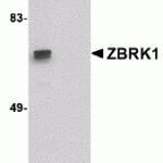 Western blot analysis of ZBRK1 in A-20 lysate with ZBRK1 antibody at 1 μg/mL in (A) the absence and (B) the presence of blocking peptide.