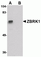 ZBRK1 Antibody