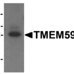 Western blot analysis of TMEM59L in rat heart tissue lysate with TMEM59L antibody at 1 μg/mL.