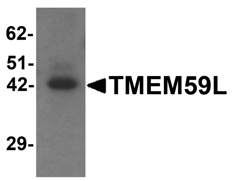 TMEM59L Antibody