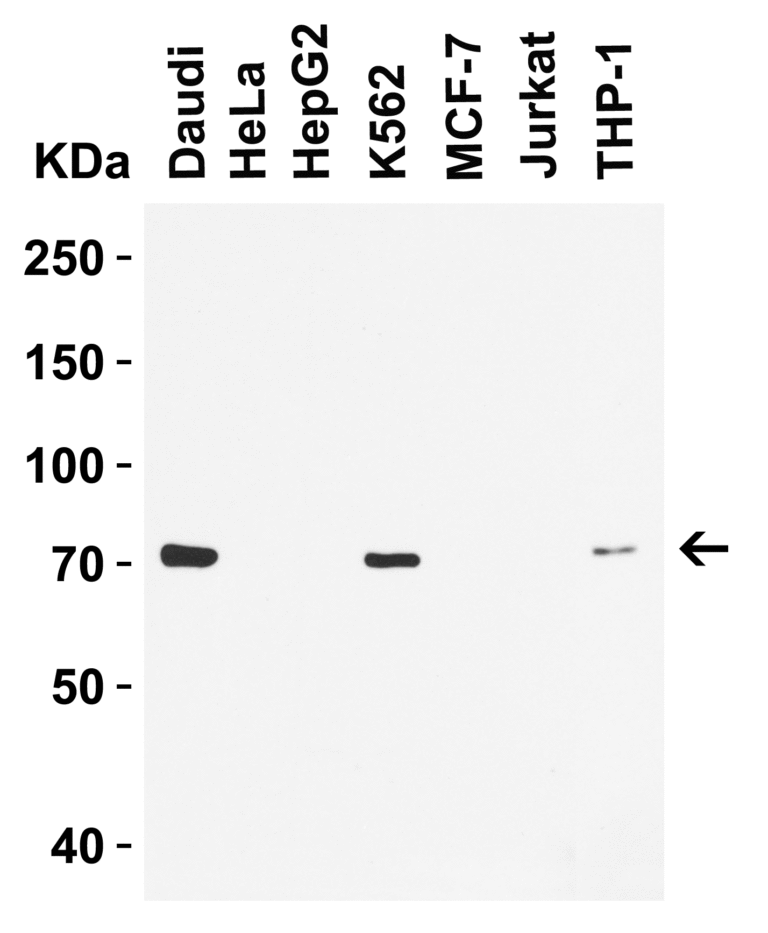 BTK Antibody