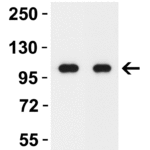 <strong> Figure 1 WB Validation in the Brain of Mouse and Rat </strong><br>Loading: 15 μg of lysate Antibodies: MDA5, 4037,2 μ g/mL , 1 h incubation at RT in 5% NFDM/TBST. Secondary: Goat Anti-Rabbit IgG HRP conjugate at 1:10000 dilution.