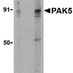 Western blot analysis of PAK5 in T24 lysate with PAK5 antibody at (A) 2 and (B) 4 μg/mL.