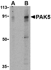PAK5 Antibody