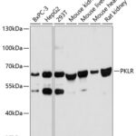 Western blot analysis of extracts of various cell lines, using PKLR antibody (14-251) at 1:3000 dilution.<br/>Secondary antibody: HRP Goat Anti-Rabbit IgG (H+L) at 1:10000 dilution.<br/>Lysates/proteins: 25ug per lane.<br/>Blocking buffer: 3% nonfat dry milk in TBST.<br/>Detection: ECL Basic Kit.<br/>Exposure time: 50s.