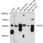 Western blot analysis of extracts of various cell lines, using NAGS antibody (14-253) at 1:3000 dilution.<br/>Secondary antibody: HRP Goat Anti-Rabbit IgG (H+L) at 1:10000 dilution.<br/>Lysates/proteins: 25ug per lane.<br/>Blocking buffer: 3% nonfat dry milk in TBST.<br/>Detection: ECL Basic Kit.<br/>Exposure time: 90s.