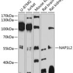 Western blot analysis of extracts of various cell lines, using NAP1L2 antibody (14-254) at 1:3000 dilution.<br/>Secondary antibody: HRP Goat Anti-Rabbit IgG (H+L) at 1:10000 dilution.<br/>Lysates/proteins: 25ug per lane.<br/>Blocking buffer: 3% nonfat dry milk in TBST.<br/>Detection: ECL Enhanced Kit.<br/>Exposure time: 90s.