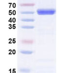 SDS-PAGE for Recombinant BCCV N/Nucleoprotein Protein, N-His