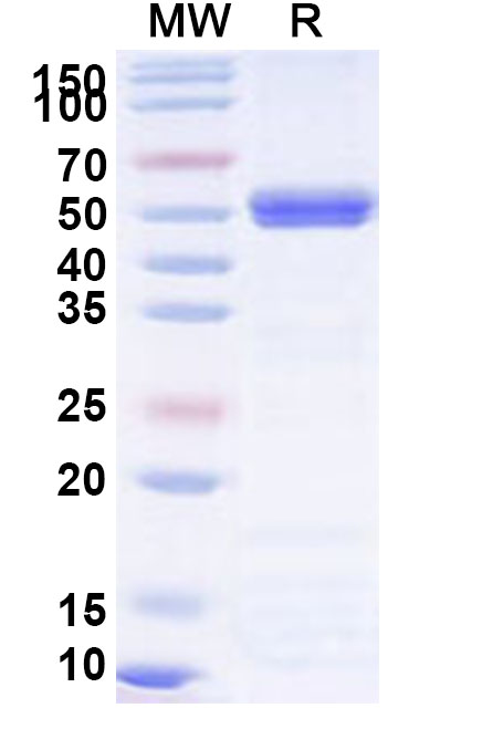 SDS-PAGE for Recombinant BCCV N/Nucleoprotein Protein, N-His