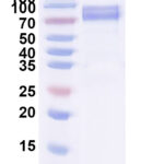 SDS-PAGE for Recombinant Orthohantavirus puumalaense Glycoprotein C/Gc, C-Fc