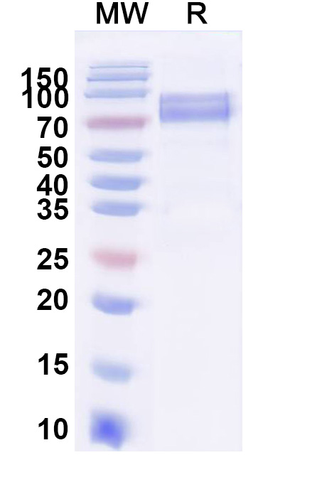 SDS-PAGE for Recombinant Orthohantavirus puumalaense Glycoprotein C/Gc, C-Fc