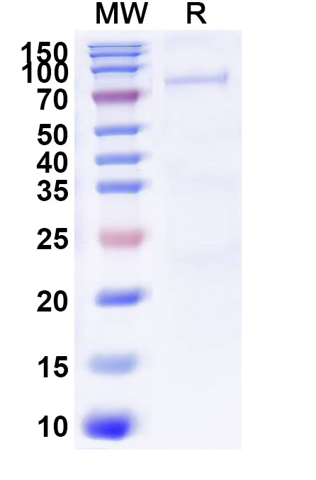SDS-PAGE for Recombinant SNV Glycoprotein Gn, C-Fc