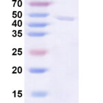 SDS-PAGE for Recombinant SNV Glycoprotein Gn, N-His