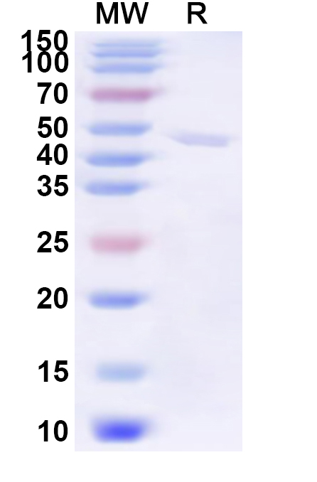 SDS-PAGE for Recombinant SNV Glycoprotein Gn, N-His