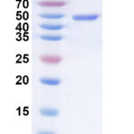 SDS-PAGE for Recombinant SNV Glycoprotein Gc, N-His