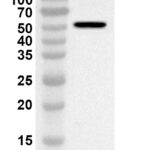 Western blot analysis was performed using anti-BCCV N/Nucleoprotein polyclonal antibody at 1ug/mL on recombinant BCCV N/Nucleoprotein (Catalog No. 31-556).